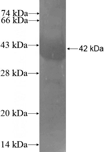 Recombinant Human MEF2C SDS-PAGE