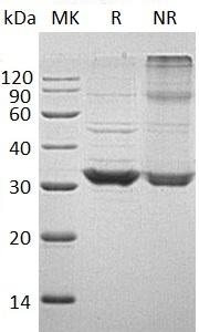 Human TOLLIP (His tag) recombinant protein