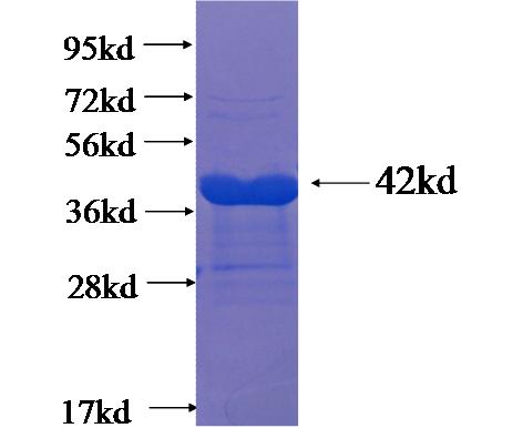 Recombinant Arabidopsis thaliana TOM20-3 SDS-PAGE