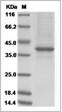 Mouse AGRP Protein (Fc Tag) SDS-PAGE