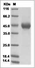 Mouse ALK-4 / ACVR1B Protein (Fc Tag) SDS-PAGE