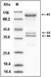 Human AMPK (G1/B1/A1) Heterotrimer Protein SDS-PAGE