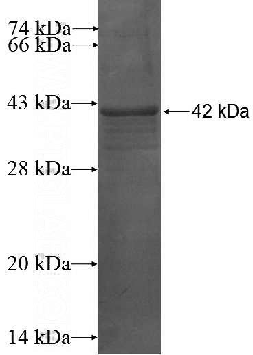 Recombinant Human SEPHS2 SDS-PAGE