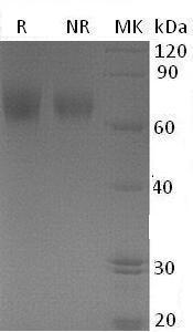 Human EGFR/ERBB/ERBB1/HER1 (His tag) recombinant protein