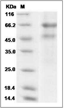 Cynomolgus ADAM8 Protein (His Tag) SDS-PAGE