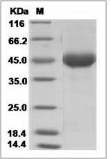 Influenza A H10N7 (A/blue-winged teal/Louisiana/Sg-00073/2007) Hemagglutinin / HA1 Protein (His Tag)