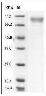 Mouse CD180 / RP105 Protein (His Tag) SDS-PAGE