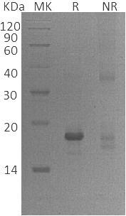 Human GADD45A/DDIT1/GADD45 (His tag) recombinant protein