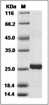 Human RGS5 / Regulator of G-protein signaling 5 Protein (His Tag) SDS-PAGE