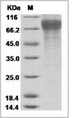 Influenza A H3N2 (A/Babol/36/2005) Hemagglutinin / HA0 Protein