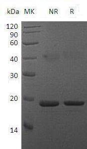 Mouse Tnfsf11/Opgl/Rankl/Trance recombinant protein