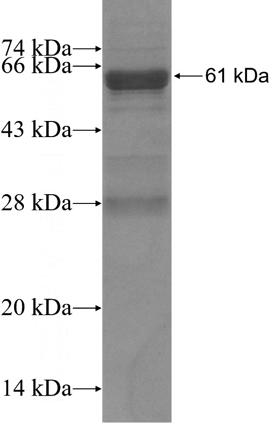 Recombinant Human SUCLG1 SDS-PAGE