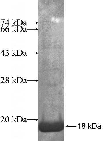 Recombinant Human C17orf37 SDS-PAGE