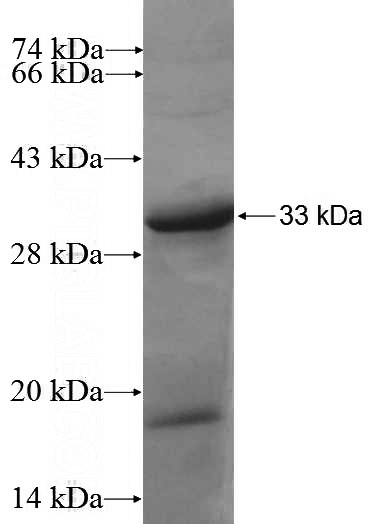 Recombinant Human TOR1A SDS-PAGE