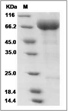 Human SIGLEC5 Protein SDS-PAGE