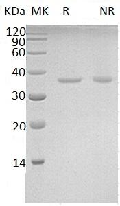 Human PRPS2 (His tag) recombinant protein