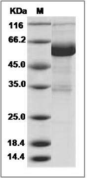 Canine IL22RA1 / IL22R Protein (Fc Tag) SDS-PAGE