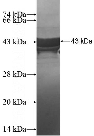 Recombinant Human CPXM2 SDS-PAGE
