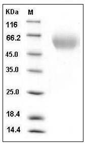 Rat KIM-1 / TIM1 / HACVR1 Protein (His Tag) SDS-PAGE