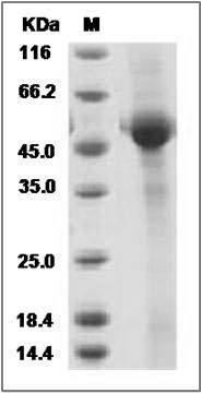 Rat CD8A / Lyt2 Protein (Fc Tag) SDS-PAGE