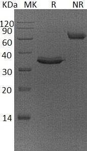 Human TNFRSF12A/FN14 (Fc tag) recombinant protein