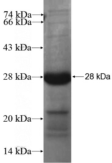 Recombinant Human CCDC71 SDS-PAGE