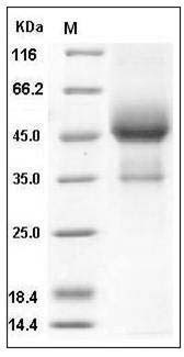 Human TGFBR1 / ALK-5 / SKR4 Protein (His & Fc Tag) SDS-PAGE