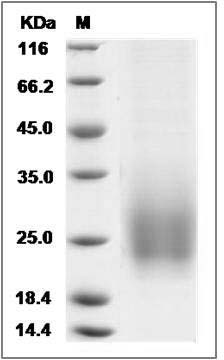 Mouse TALLA-1 / TSPAN7 Protein (His Tag) SDS-PAGE
