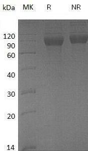 Human DCBLD2/CLCP1/ESDN (His tag) recombinant protein