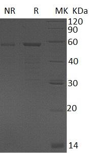 Human GAS7/KIAA0394 (His tag) recombinant protein