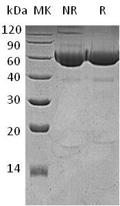 Human LGMN/PRSC1 (His tag) recombinant protein
