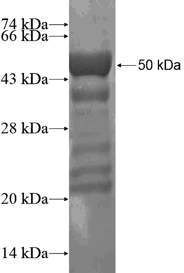 Recombinant Human KDM2A SDS-PAGE