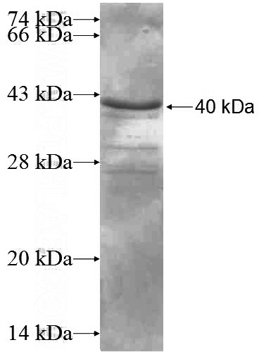 Recombinant Human DCDC2 SDS-PAGE