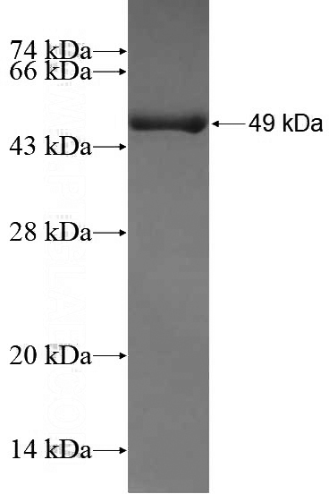 Recombinant Human STEAP3 SDS-PAGE
