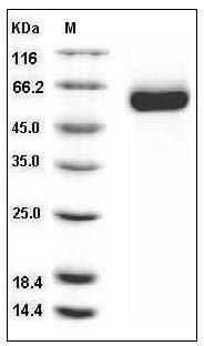 Human DLL1 / Delta-1 Protein (His Tag) SDS-PAGE