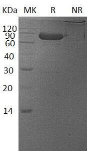 Human VSIG4/CRIg/Z39IG/UNQ317/PRO362 (Fc tag) recombinant protein
