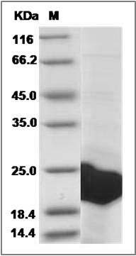 Human EEF1E1 / AIMP3 / p18 Protein (His Tag) SDS-PAGE