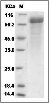 Rat Cadherin-8 / CDH8 Protein (His Tag) SDS-PAGE