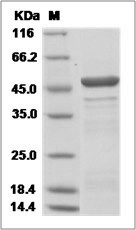 Hantaan virus HTNV (strain 84FLi) Nucleocapsid / NP Protein (His Tag)