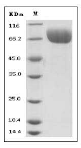 Human CD276 / B7-H3 Protein (His Tag), Biotinylated