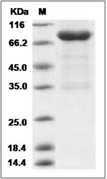Rat UNC5B / UNC5H2 Protein (Fc Tag) SDS-PAGE