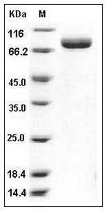 Mouse TLR3 / CD283 Protein (His Tag) SDS-PAGE