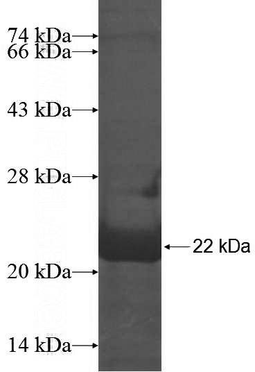 Recombinant Human C9orf72 SDS-PAGE