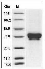 Human STIM1 / GOK Protein (His Tag) SDS-PAGE