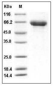Influenza A H16N3 (A/black-headed gull/Sweden/5/99) Hemagglutinin / HA Protein (His Tag) SDS-PAGE