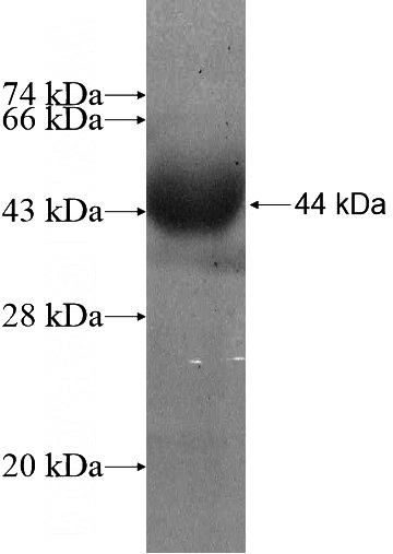 Recombinant Human GSTCD SDS-PAGE