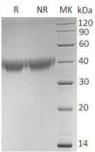Human HAVCR2/TIM3/TIMD3 (His tag) recombinant protein