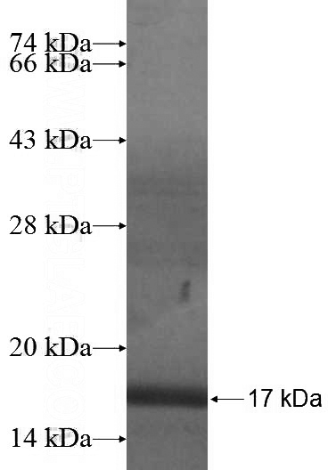 Recombinant Human ISOC2 SDS-PAGE