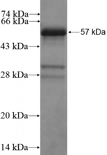 Recombinant Human ZKSCAN3 SDS-PAGE