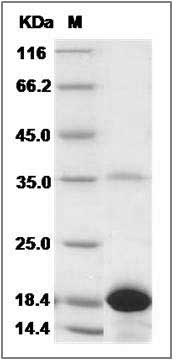 Human PTS / PTPS Protein (His Tag) SDS-PAGE